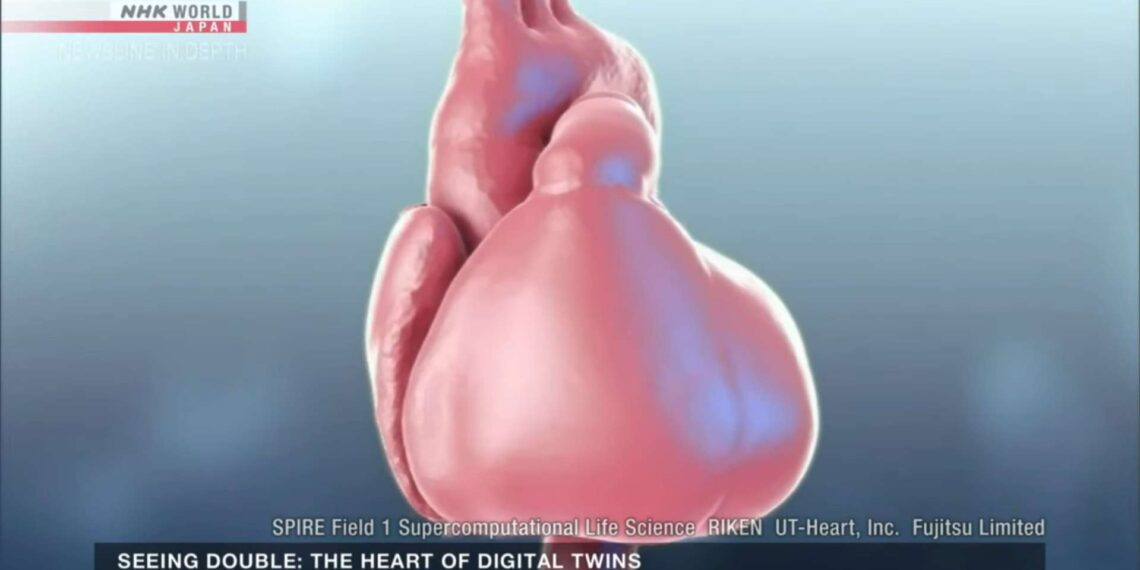 Heart Digital Twin